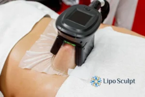 Cryolipolysis Helping You Getting that Perfect Summer Body 3 Cryolipolysis Marlow can give you the best summer body - contact us today!