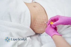 Are The Results From Aqualyx Permanent? 1 Do you want to know how long Aqualyx Marlow results last?